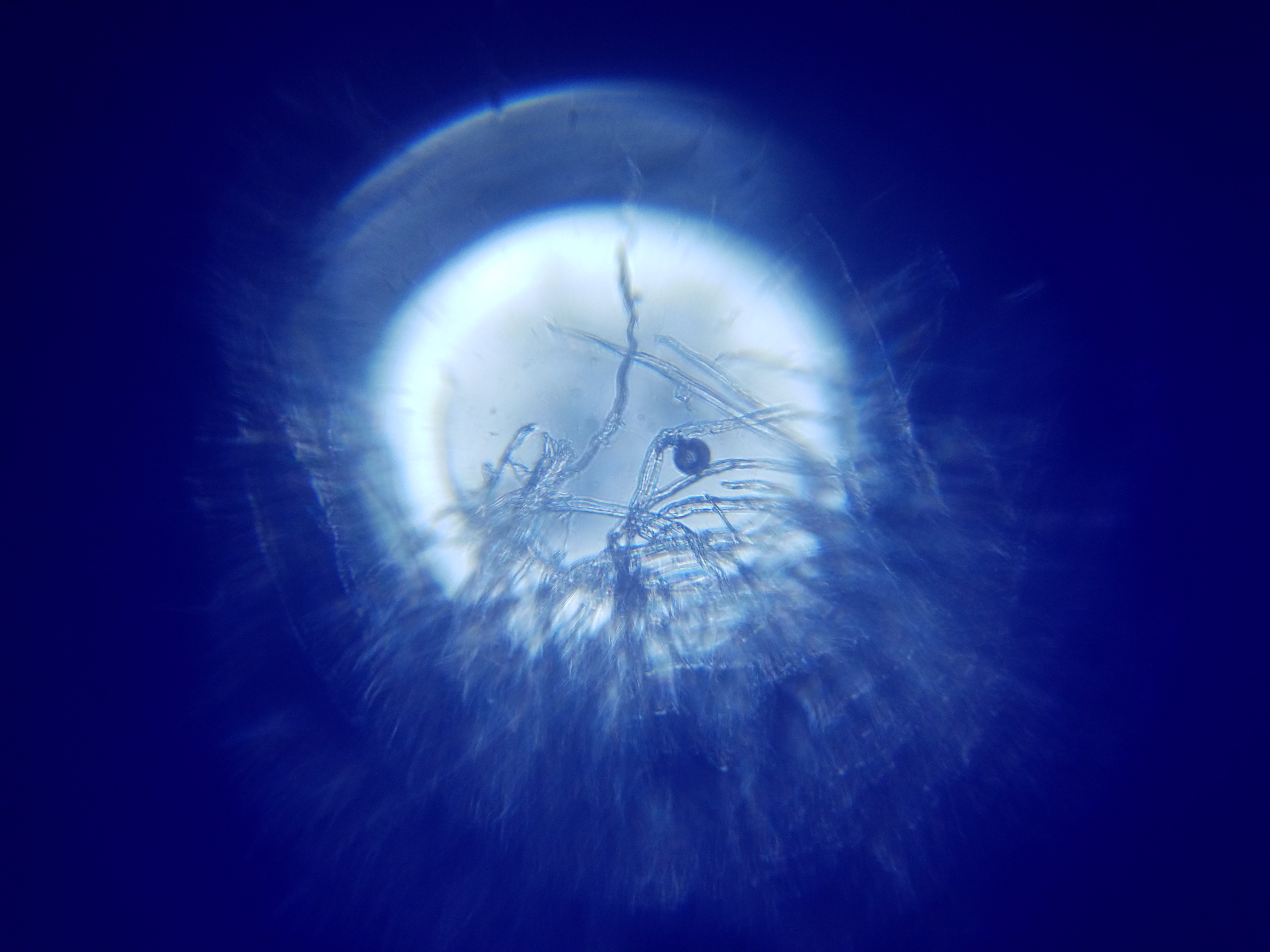 A central halo is surrounded by a vignette of blue. Ontop of the halo are semi-transparent threads. Among the threads, there is a single circular object of unkown orgin. A central halo is surrounded by a vignette of blue. Ontop of the halo are semi-transparent threads. Among the threads, there is a single circular object of unkown orgin.